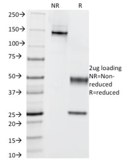 Complement C4b/d Antibody (C4D203), Novus Biologicals:Antibodies:Primary